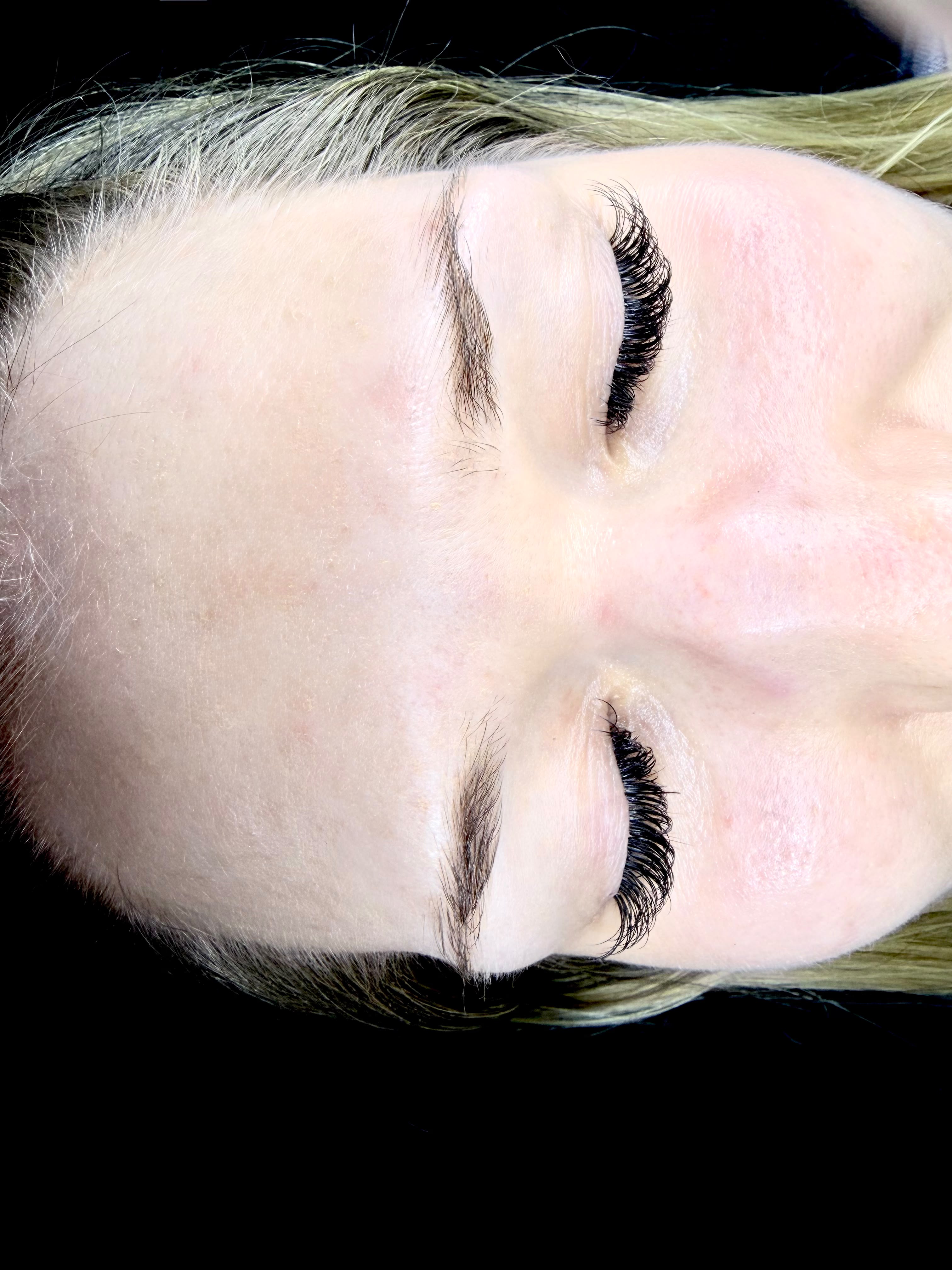 Augenbrauen vor dem Browlift